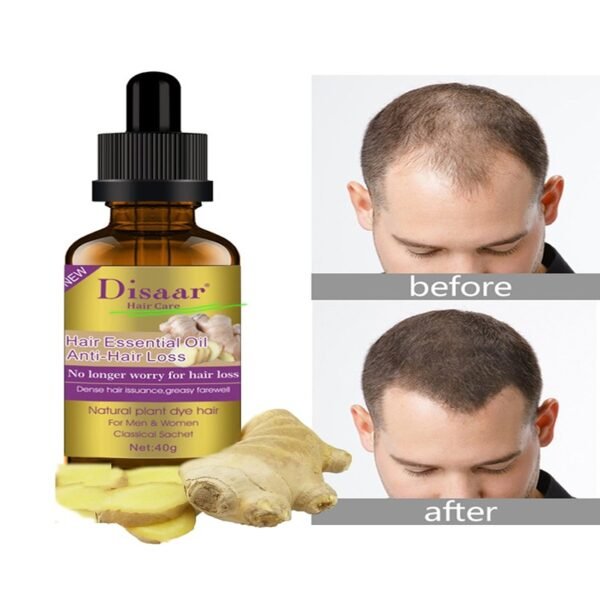 Disaar Anti Hair Loss Essence Hair Thinning Treatment